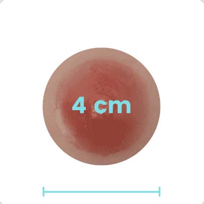 4cm