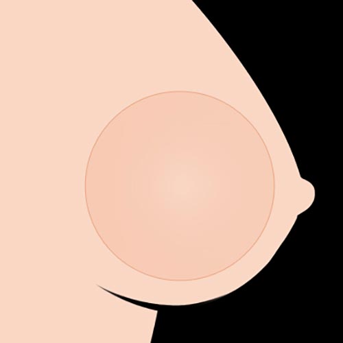 Gel Breasts (FREE)